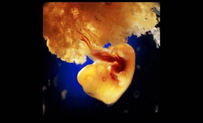 40 ngày phát triển. Các tế bào bên ngoài của thai nhi tham gia với bề mặt rộng của bức tường tử cung để tạo thành nhau thai.